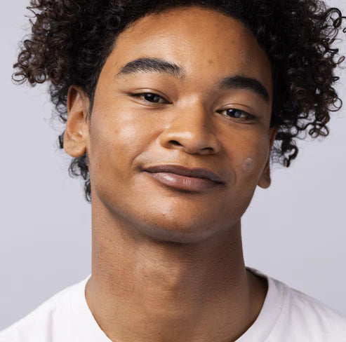 InvisiClear™ Hydrocolloid Spot Patches--25 patch pack